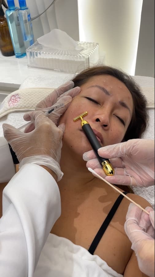 Botox at SOI Clinic