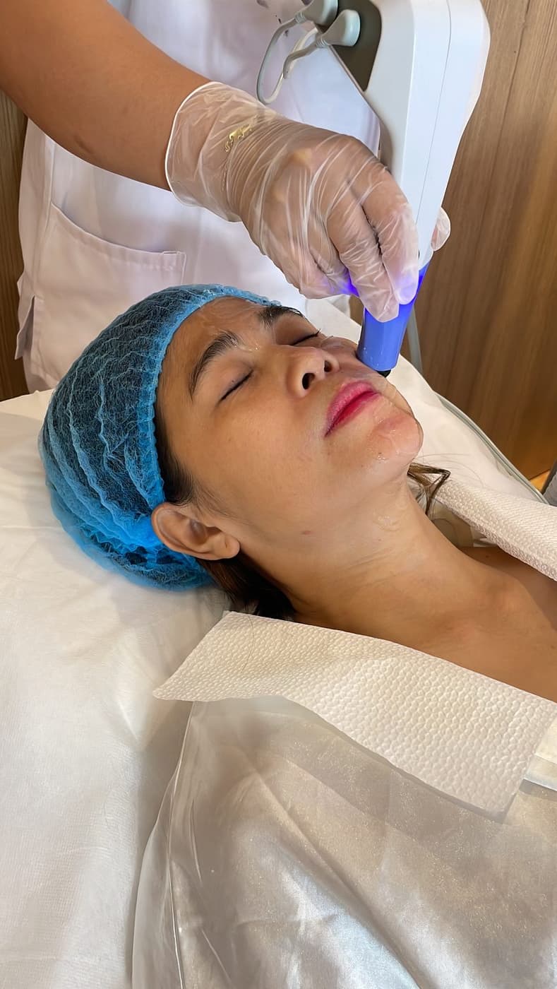 Facial Contouring