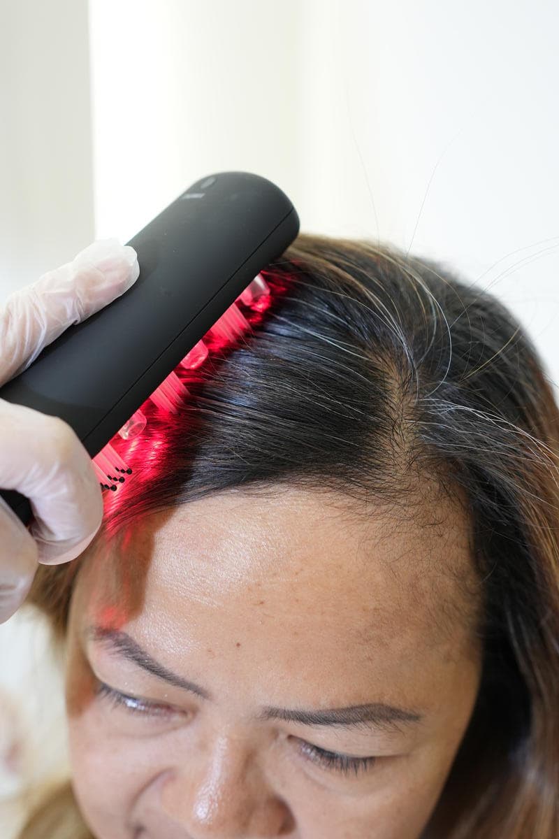 Hair Regrowth Therapy detail